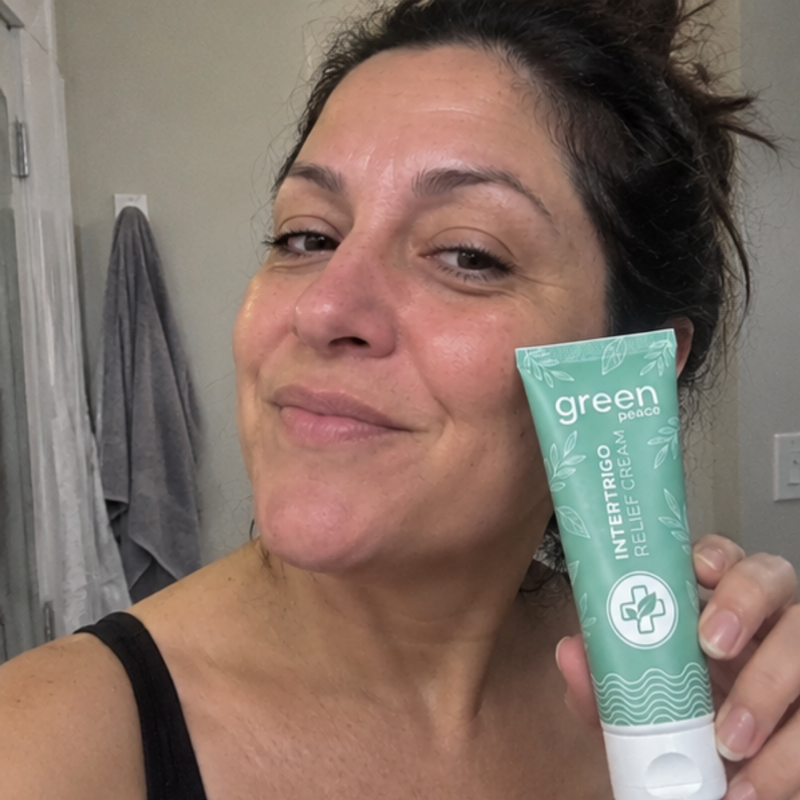 Skin fold cream tube held in the hand
